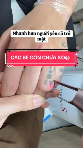 Định để hình xăm tự mờ ư. Khum có đâu ạ .#xoaxam #xoámàybắcninh #xoaxamlaser #xoaxăm #xoaxambacninh 