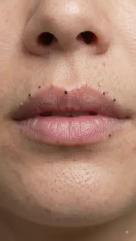 black heads remove for lips. #removeblackheads #facecleaning #creatorsearchinsights #faceclean #viral 