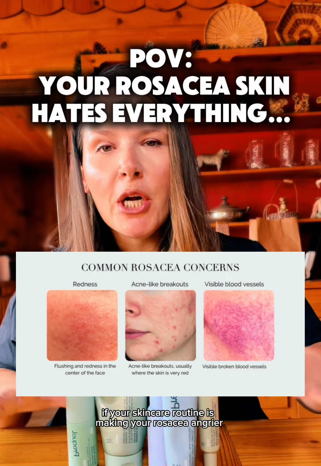 If your rosacea skincare routine is suddenly burning, stinging, or making your skin feel even more reactive, MORE skincare may not be the answer. 🔥 I’m a nurse, former cosmetologist, and someone with rosacea, and this is when I start looking at how I can simplify my routine and focus on gentle cleansing, soothing hydration, and skin barrier support. I’m breaking down the Prequel Rosacea Seal Routine and what each product is actually doing for redness-prone, sensitive skin—because sometimes angry skin needs a simpler routine, not another active. @Prequel  #RosaceaSkincare #RosaceaRoutine #SensitiveSkin #SkinBarrier #tiktokshopstockup 