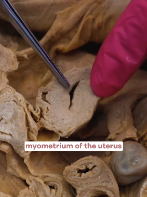 Period cramps aren't just 
