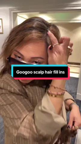 @googoohair_magic #scalphairvolume #hairlinerestoration #hairline 