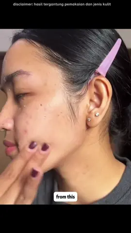 Exfoliating Gel Chalonese bikin kulit terasa lebih fresh 🌿 #geleksfoliasi #eksfoliasi #GlowUp #exfoliating #bodycare