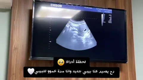 @𝐻𝑎𝑙𝑎🦢.   ألف مبروك يا سلفتي الحلوة على أول حمل  يا أول فرحة وأحلى بيبي جاي لعيلتنا  ربي يتمملك على خير، ونشوفك أحلى ماما ونفرح فيكي يا رب 🤍🥹