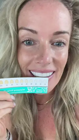 I don’t think they could get MORE white?! #whiteningstrips #teethwhitening #smilemakeover #gurunanda 