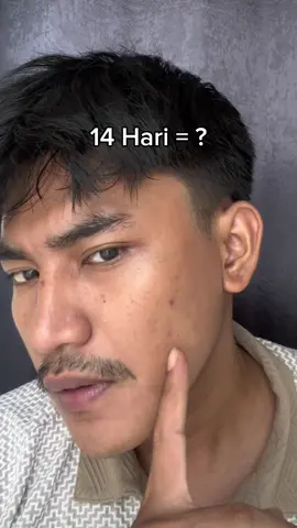 beli fw yang beneran bikin muka glow max, liat bedanyaa😜#msglowformen #msglowmenyuks 