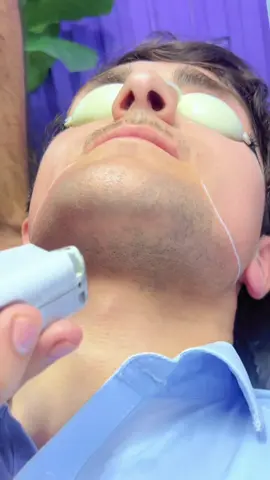 Laser hair removal 