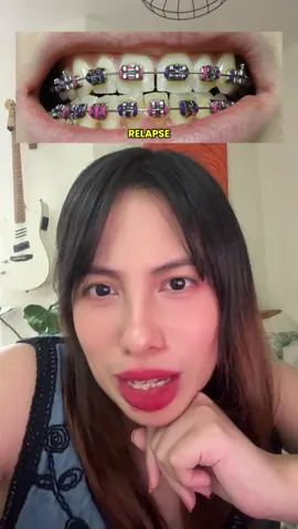 Did your teeth relapse after braces? #teeth #dental #learnontiktok #education 🦷