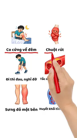 ĐAU BẮP CHÂN KIỂU NÀO, COI CHỪNG BỆNH GÌ ▪️ Co cứng về đêm → chuột rút ▪️ Đi thì đau, nghỉ đỡ → tắc động mạch chân ▪️ Sưng đỏ một bên → huyết khối tĩnh mạch ▪️ Gân xanh ngoằn ngoèo → suy giãn tĩnh mạch ▪️ Nhói như bị đá → rách cơ bắp chân ▪️ Lan từ mông, kèm tê → thần kinh tọa ▪️ Đang dùng thuốc mỡ máu → tác dụng phụ thuốc ▪️ Sau gót lên bắp chân → viêm gân gót Bắp chân một bên sưng đỏ, nóng, đau đột ngột — đi khám ngay. 👉 Đọc thêm tại website Bác sĩ Chúc ⚠️ Nội dung mang tính tham khảo, không thay thế thăm khám bác sĩ. #daubapchan #chuotrut #huyetkhoi #suygiantinhmach #suckhoe #bacsichuc #drchuc