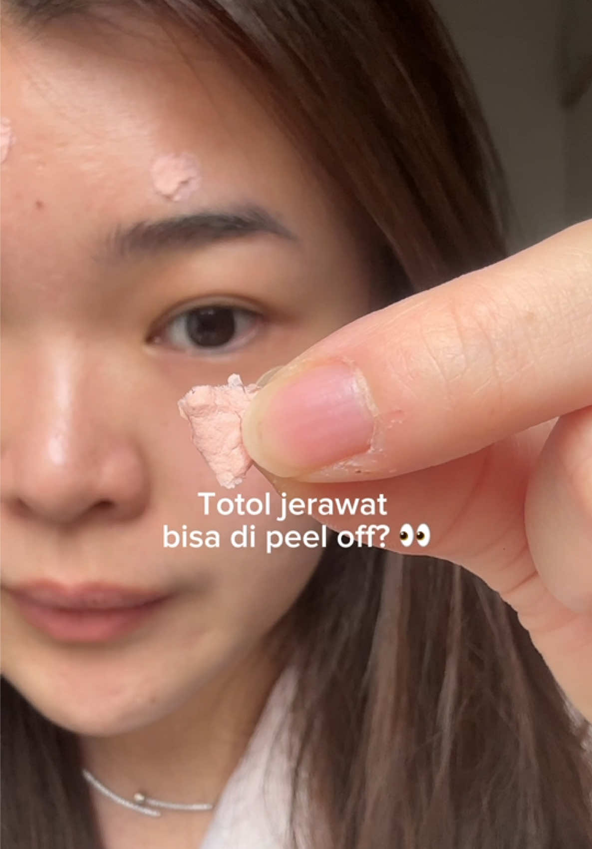 uda gatau abis berapa tube, satu'nya totol jerawat yang aku pake 😙💗 #acnefighter #totoljerawat #acnetreatment 