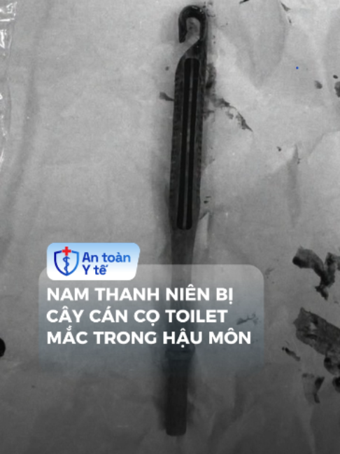 Nam thanh niên bị cán cây cọ toilet mắc trong hậu môn #antoanyte #tiktoknew #songkhoe247 #dgh