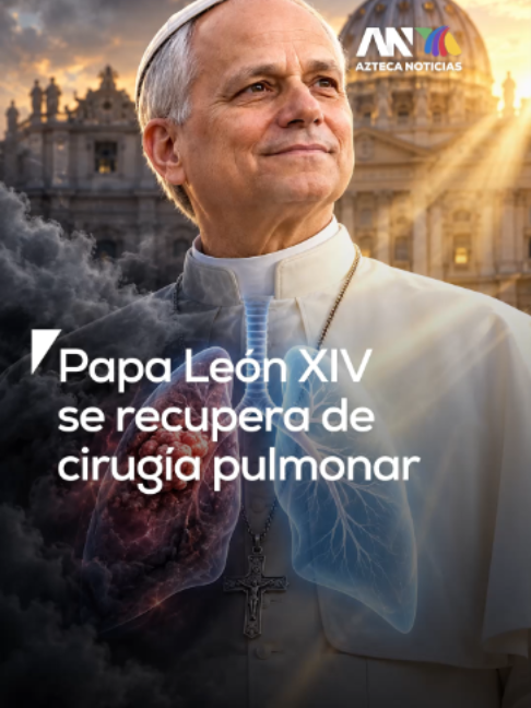 El papa León XIV fue operado de emergencia tras detectarle un cáncer de pulmón.  Los médicos del Hospital Gemelli le extirparon el lóbulo inferior del pulmón derecho en una intervención de noventa minutos que concluyó sin complicaciones.  Sus actividades públicas permanecen suspendidas mientras cumple su periodo de recuperación en Roma, un descanso necesario que le permitiría mantener su gira por América Latina programada para noviembre. Daniel Rivera nos cuenta los detalles.  #PapaLeónXIV #LeónXIV #CáncerDePulmón  Papa León XIV, cáncer de pulmón, cirugía Roma, Hospital Gemelli, salud papal