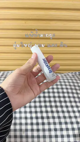 เลี้ยงงลูกไม่ให้โดนยุงกัดด