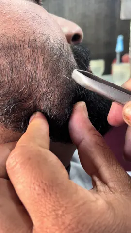 ASMR white hair  beard removed #foryou #asmr #hair #