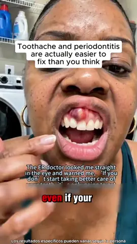sks Bleeding Gums + Bad breath? Watch This.#TeethWhitening#badbreath #stain  #OralCare #TikTokShopFinds  