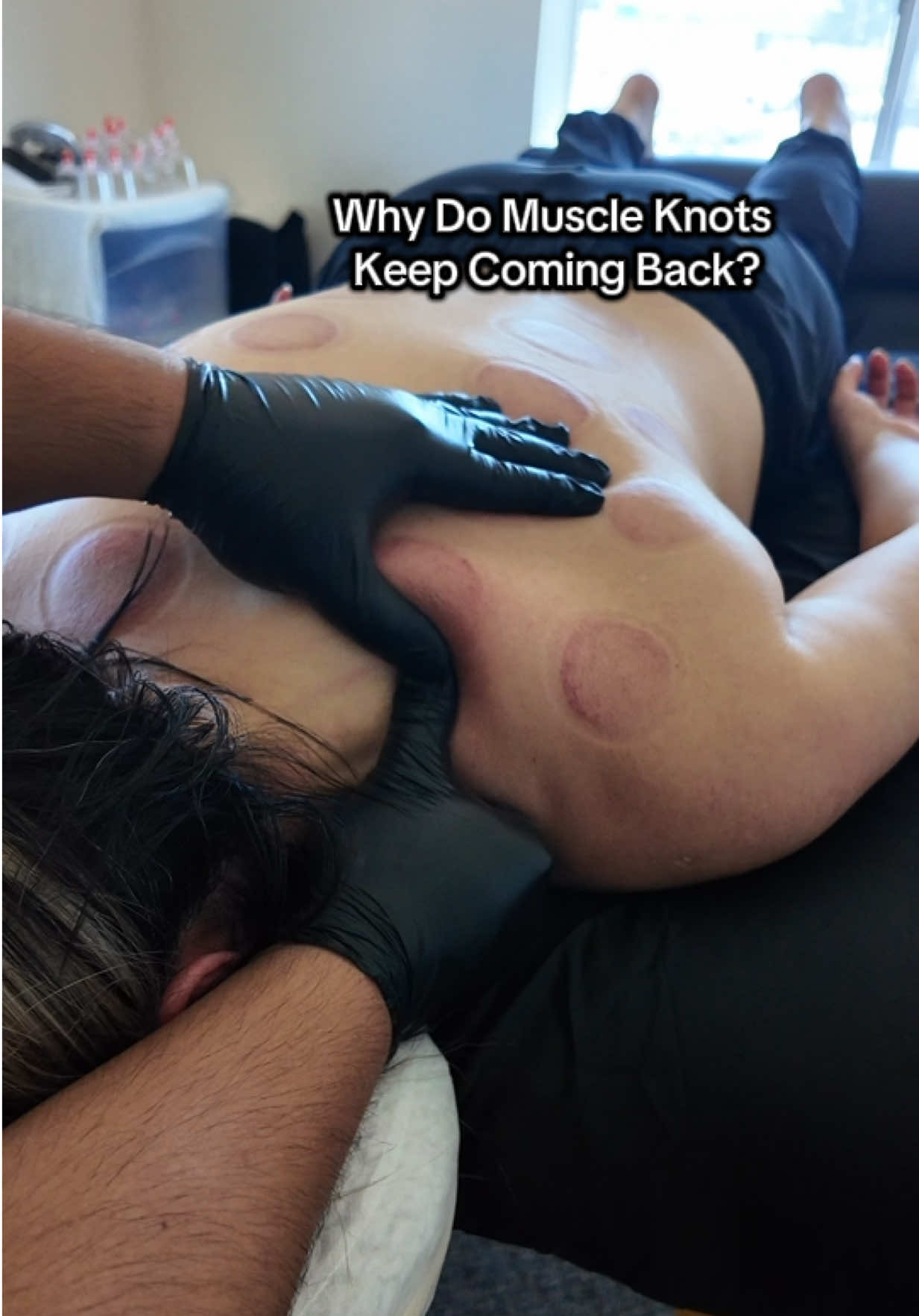 Muscle knots, often called myofascial trigger points, are sensitive areas within muscle tissue that may cause localized discomfort or pain that spreads to surrounding areas. They can develop alongside muscle overuse, repetitive movements, prolonged postures, and increased physical stress. When a muscle repeatedly handles more demand than it can comfortably tolerate, sensitivity and protective muscle tension may increase. This can make everyday movements feel stiff or uncomfortable, especially in areas like the neck, shoulders, and upper back. Manual therapy, stretching, and manipulation can help reduce discomfort and improve movement by influencing pain sensitivity and muscle tone. However, lasting improvement may also require addressing contributing factors such as movement habits (functional patients), recovery, and strength. #massage #painrelief #SelfCare #fyp #tiktok 