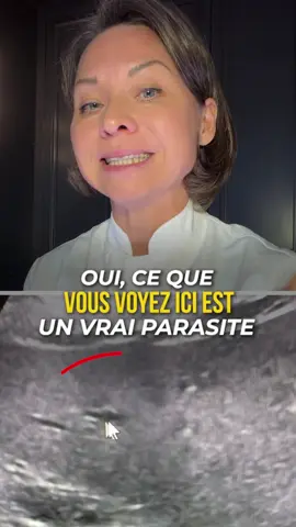 🌿 Lien dans ma bio ou sur www.evobreeze.com. Faites votre diagnostic capillaire en 5 minutes pour découvrir la cause de vos problèmes de cheveux. Quels examens faire pour rechercher des parasites ? 1. Commencez par une prise de sang — NFS avec éosinophiles. Un taux élevé d’éosinophiles peut faire suspecter une infection parasitaire, notamment par certains vers. 2. Recherche de parasites dans les selles — Examen parasitologique des selles : recherche d’œufs, de larves et de parasites. — Idéalement, 3 prélèvements à des jours différents selon le parasite recherché. — PCR parasitaire : recherche de l’ADN de certains parasites, selon le panel du laboratoire. La présence de certains parasites peut perturber l’absorption des nutriments, entraîner des carences et contribuer à la chute des cheveux.