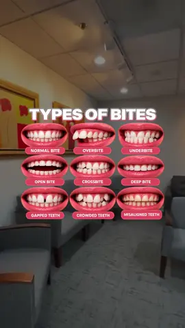 How many types of bites can you spot? 🦷👀 Normal bite, overbite, underbite, open bite, crossbite, deep bite, gapped, crowded, and misaligned teeth are some common bite patterns. Which one did you notice first? 👇 If you’re concerned about your bite or how your teeth come together, a dental evaluation can help. 📍 Smile Design Centre 31700 Telegraph Rd, Suite 100, Bingham Farms, MI 48025 ☎️ (313) 356-7577 🔗 Link in bio to schedule your visit #smiledesigncentre #typesofbites #overbite #underbite #crossbite 
