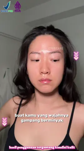 Wajah terasa lebih fresh setelah dibersihkan? Yuk, mulai rutinkan penggunaan Anti Acne Cleanser ✨🫧 #Cyeecare #Cyeecare4u #sabunmukasalicylicacid #pembersihwajahjerawat #cleanserantiacne #kulitberminyak #hilangkankomedo #skincareoilyskin #fypkulitberminyak #pembersihpori #tipskulitberjerawat #bpomskincare