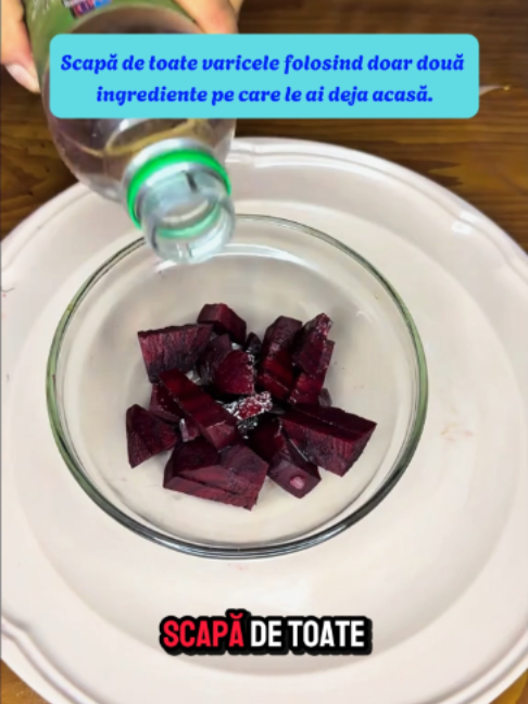 Scapă de toate varicele folosind doar două ingrediente pe care le ai deja acasă.#tik_tok #foo #tipp #cook #recipes