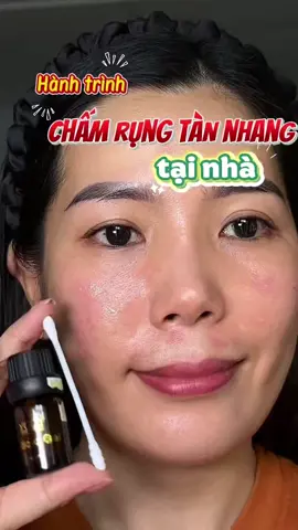 Hành trình chấm tàn nhang rụng sau 5-7 ngày tại nhà cùng e Khuy nhé#khuyle #mypham #tinhchathutsacto #peel #xuhuongtiktok 