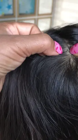 To easily catch lice,use fake fingernails.#trend #goviral #lice #humor #f 
